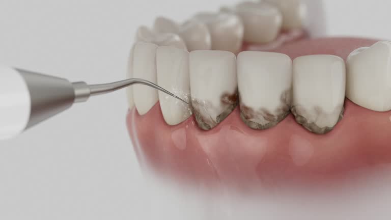 Reliable Tooth Extraction contractor in Hartley, CA by Smile Center Dentistry